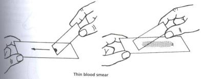 Glass slides for making blood smears 